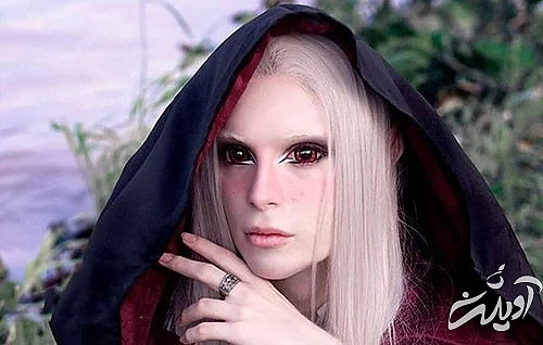 عجیب‌ترین و مضحک‌ترین جراحی‌های زیبایی